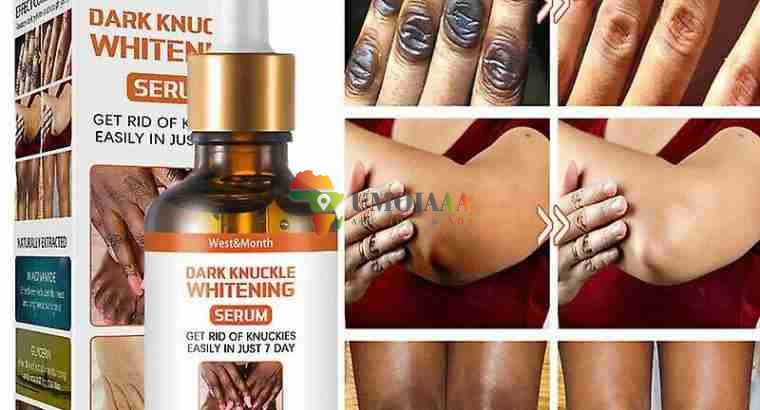 Get Rid Of Vitiligo And Tattoos In Cross...