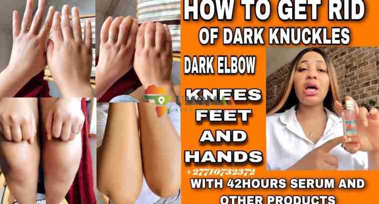 Get Rid Of Vitiligo And Tattoos In Cross City In Florida