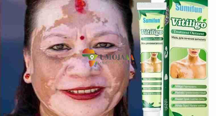 Get Rid Of Vitiligo And Tattoos In Cross City In Florida