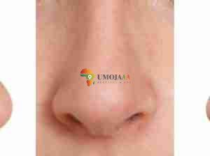 Nose sharpening cream and pills call